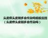头皮痒头皮屑多会传染吗蚂蚁庄园（头皮痒头皮屑多会传染吗）