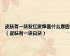 皮肤有一块发红发痒是什么原因（皮肤有一块白块）