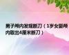 男子颅内发现断刀（1岁女婴颅内取出4厘米断刀）