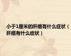 小于1厘米的肝癌有什么症状（肝癌有什么症状）