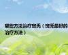 哪些方法治疗斑秃（斑秃最好的治疗方法）