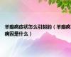 羊癫疯症状怎么引起的（羊癫疯病因是什么）