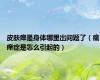 皮肤痒是身体哪里出问题了（瘙痒症是怎么引起的）