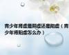 青少年肾虚是阴虚还是阳虚（青少年肾阳虚怎么办）