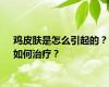 鸡皮肤是怎么引起的？如何治疗？