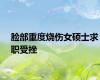脸部重度烧伤女硕士求职受挫