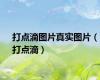 打点滴图片真实图片（打点滴）