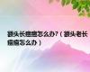 额头长痘痘怎么办?（额头老长痘痘怎么办）