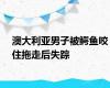 澳大利亚男子被鳄鱼咬住拖走后失踪