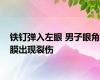 铁钉弹入左眼 男子眼角膜出现裂伤
