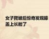 女子爬坡后惊奇发现膝盖上长脸了