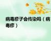 病毒疹子会传染吗（病毒疹）