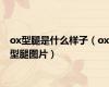 ox型腿是什么样子（ox型腿图片）